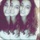 [w],acelya-,27,yessss_