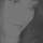 [w],svea,33,svea